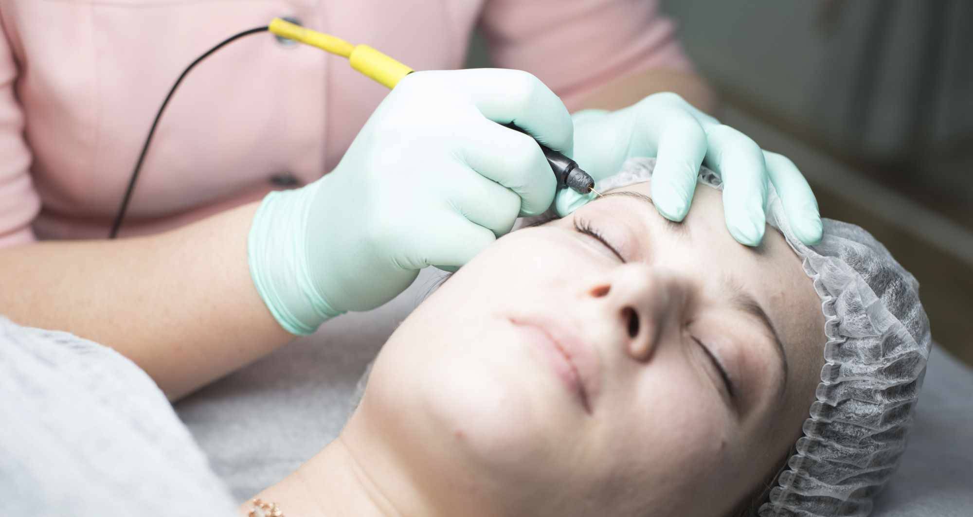 electrolysis hair removal clinic in Cardiff