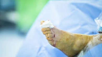 Why Choose Foot And Ankle Center Of Arizona For Matrixectomy Procedures